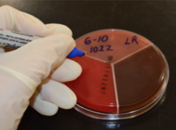 A gloved hand holds a marker to a tri-plate filled with different samples.